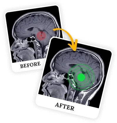 Billionaire Brain Wave programs